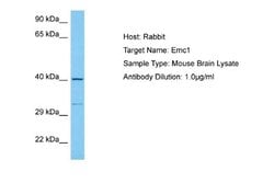 EMC1 Antibody, Novus Biologicals 100 &mu;L; Unconjugated:Antibodies, Polyclonal
